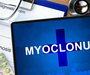 Mioklonie (ruchy mimowolne): przyczyny, objawy, leczenie