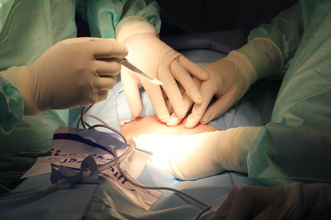 Chirurdzy z krakowksiego szpitala pomylili organy
