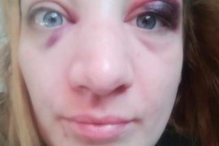 Pomóżcie mi wyrwać się z sąsiedzkiego piekła.