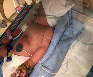 Apel o pomoc dla bliźniaków