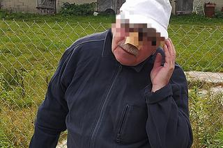 Krwawa przygoda gospodarza z Mazowsza. Krowa Baśka zjadła mu nos