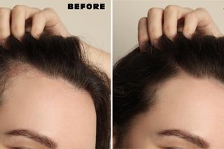 W ogrodzie zrywam to zielsko i gotuję w małym garnuszku. Gdy przestygnie wcieram w głowe. Włosy rosną jak szalone. Wcierka na porost włosów, która działa lepiej niż wysokopółkowe kosmetyki 