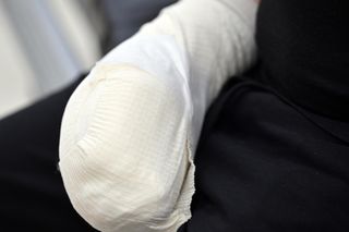 Lekarze z 5 Wojskowego Szpitala Klinicznego w Krakowie przyszyli oderwany kciuk panu Wojciechowi