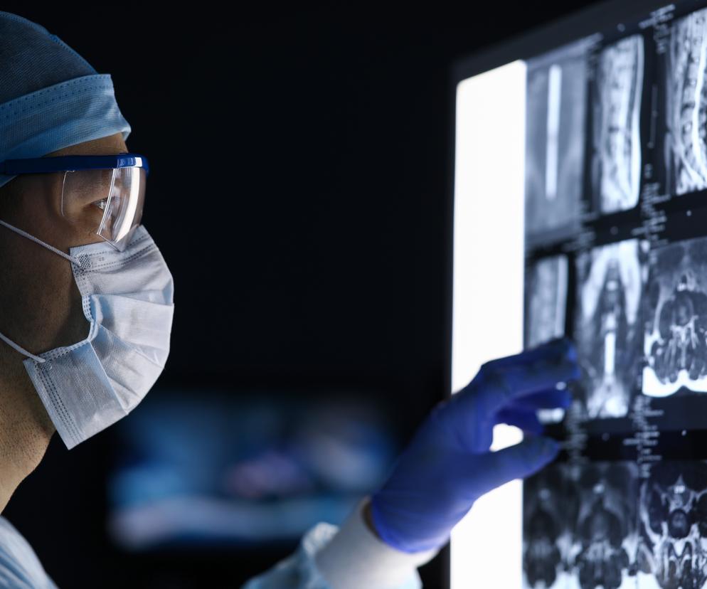 Szczepionka przeciw złośliwemu rakowi mózgu naprawdę działa? Obiecujące doniesienia 