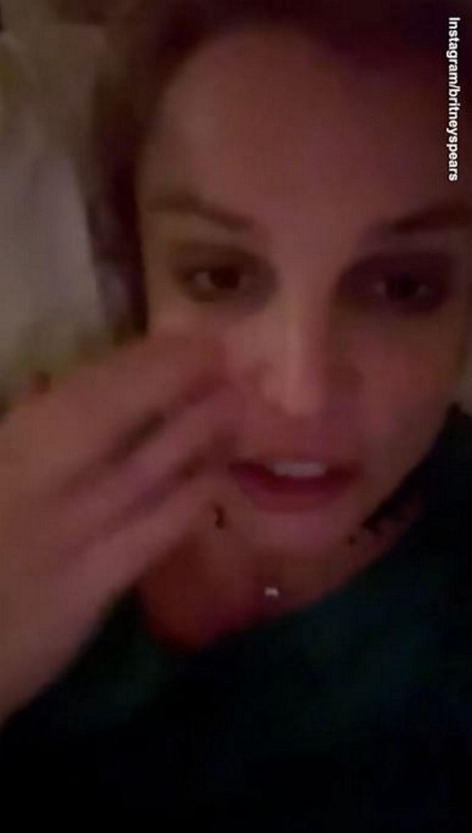 Britney Spears spaliła sobie twarz! Wypadek gwiazdy przy kominku