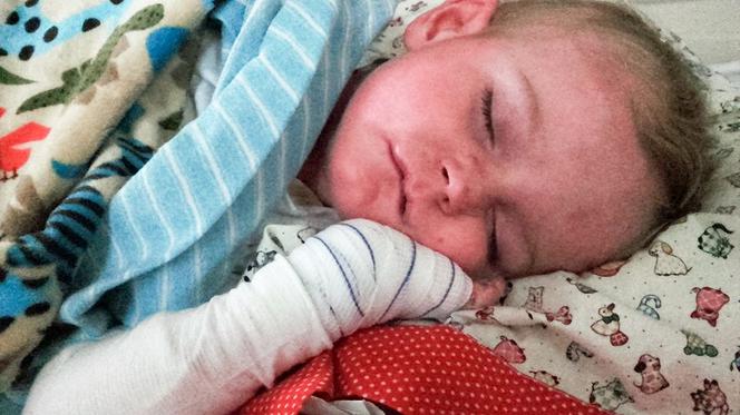 Moja skóra mnie zabija