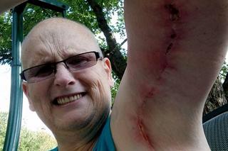 Najgrubszy człowiek świata schudł 300 kilogramów 