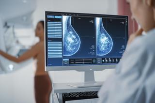 Nowe opcje leczenia dla kobiet z rakiem piersi