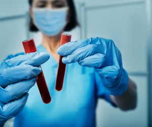 Nowy test na raka z krwi. Czy warto mu ufać? 