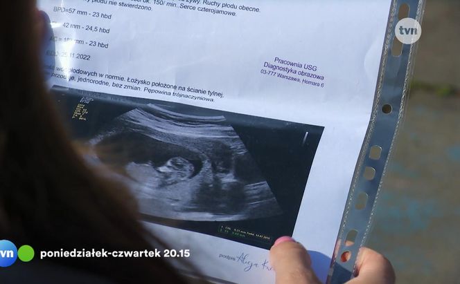 Na Wspólnej odc. 4058: Aneta Siwek (Dorota Krempa)