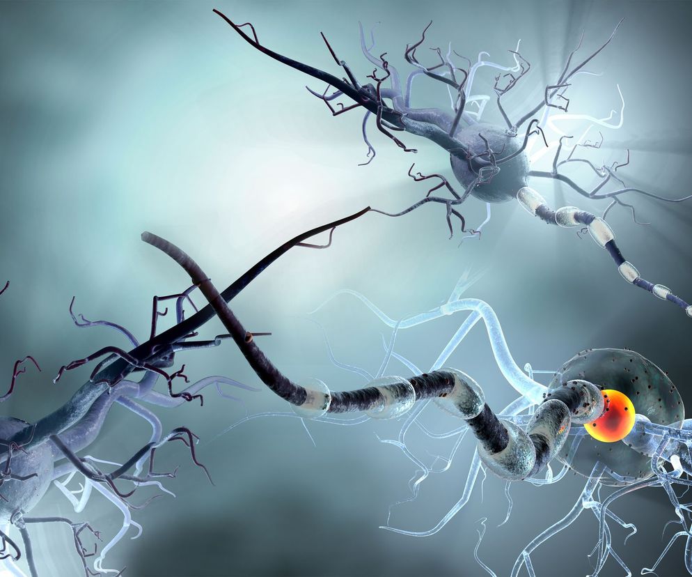 Zespół Westa to zespół padaczkowy charakterystyczny dla populacji dziecięcej.