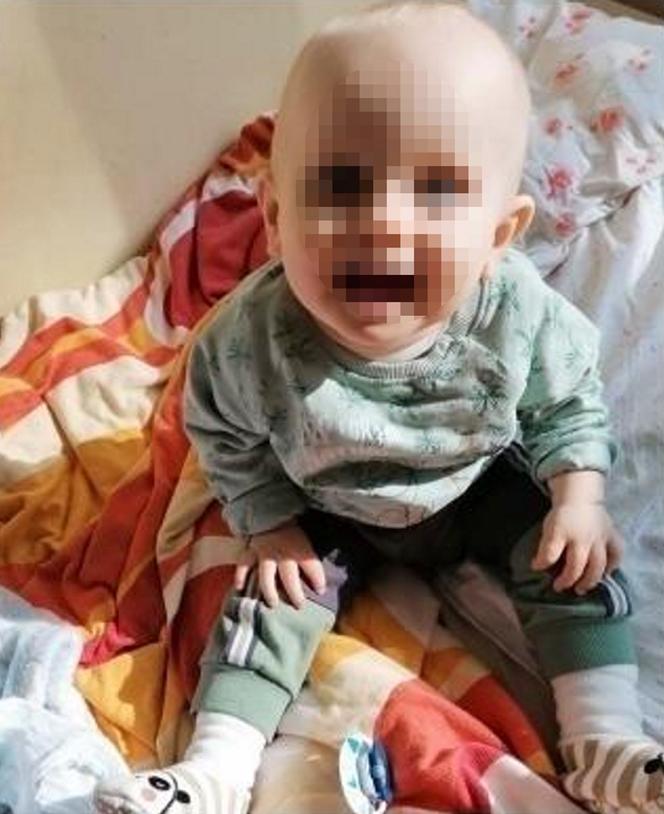 Mały Marcelek z Wyszogrodu walczy o powrót do normalności! Jego mama dowiedziała się o chorobie synka w dniu porodu [ZDJĘCIA]