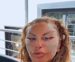 Dagmara Kaźmierska po operacji twarzy