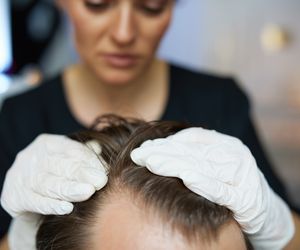 Jak wygląda wizyta u trychologa? Diagnostyka i leczenie skóry głowy oraz włosów