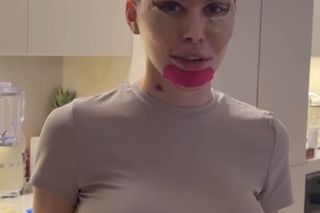 Julia von Stein po operacji