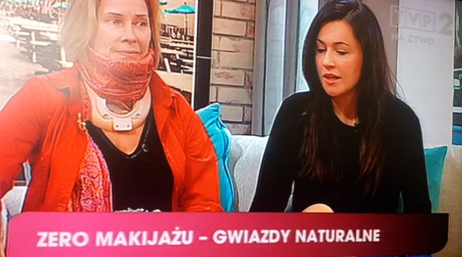 Małgorzata Potocka w kołnierzu ortopedycznym