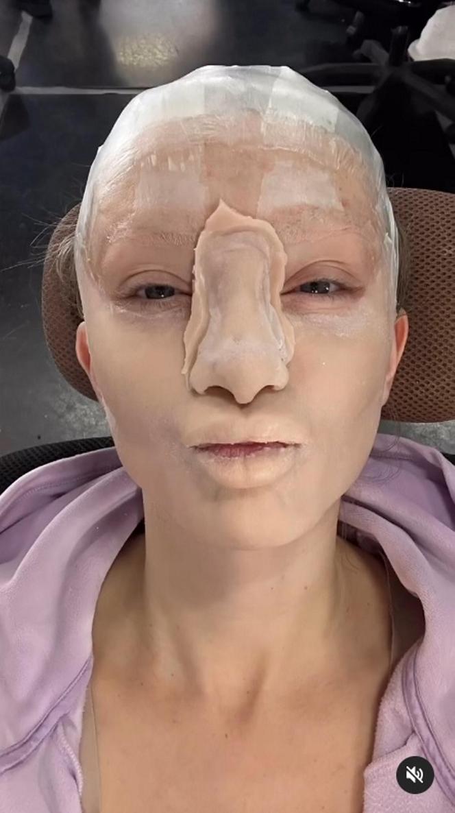 Basia Kurdej-Szatan oszpecona