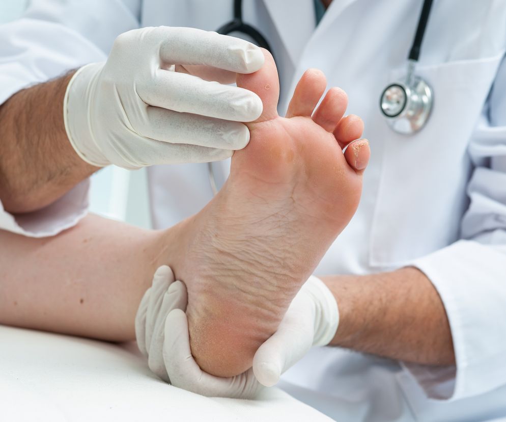 Odruch Babińskiego - przyczyny. O czym świadczy odruch Babińskiego u dzieci i dorosłych?