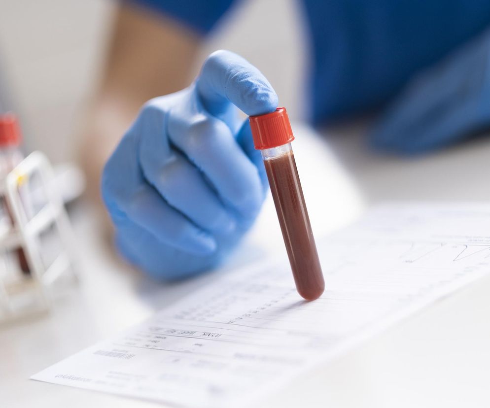 Wystarczy kropla krwi, by przewidzieć 67 chorób? Sekret tkwi w niewielkiej cząsteczce