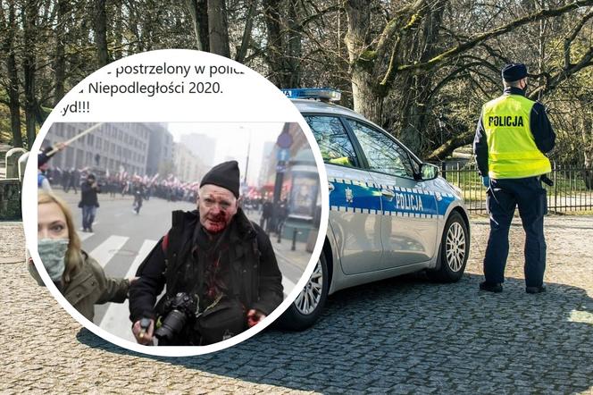 SKANDAL na Marszu Niepodległości 2020. Tomasz Gutry, legendarny fotoreporter, postrzelony przez policję?