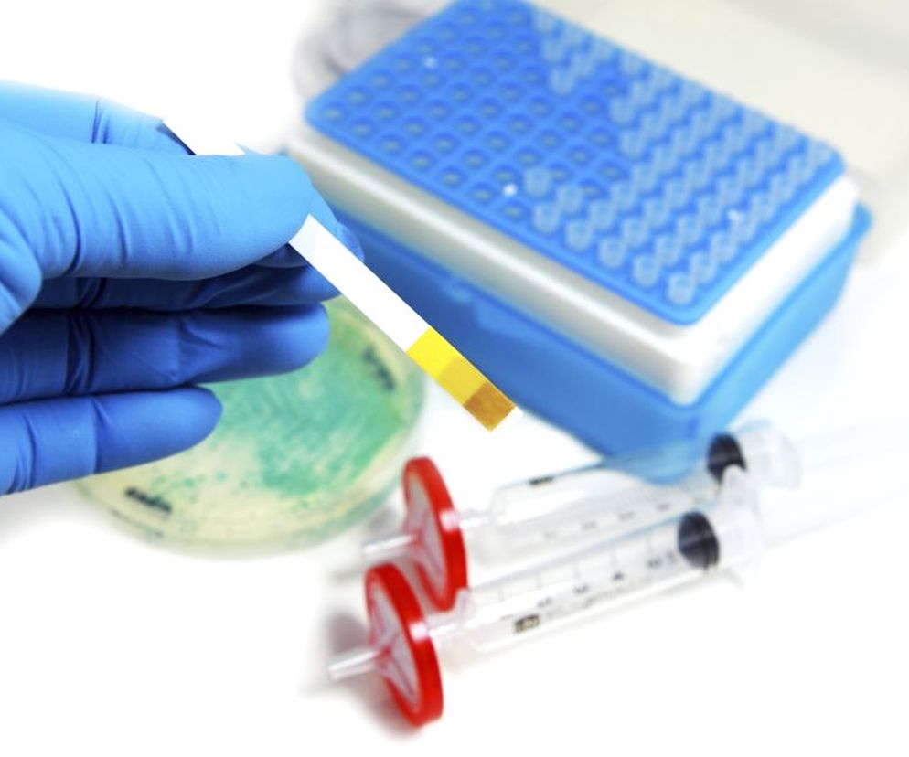 Kwasica mleczanowa  to zaburzenie metaboliczne, które jest wynikiem nadmiernego gromadzenia się mleczanów w organizmie. Jakie są przyczyny i objawy kwasicy mleczanowej? Na czym polega leczenie?