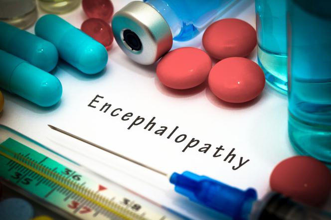 Encefalopatia nadciśnieniowa: przyczyny, objawy, leczenie
