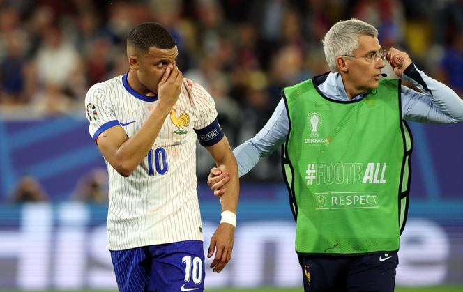 Kontuzja nosa Mbappe podczas Euro 2024