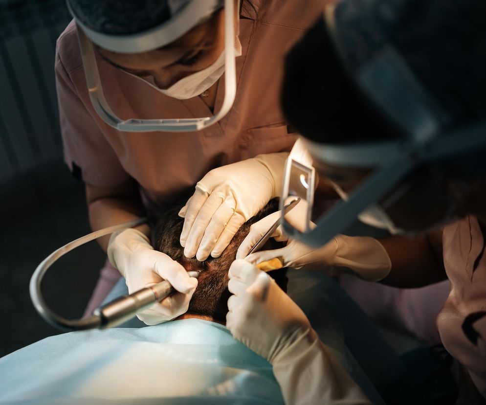 Śmierć po przeszczepie włosów. Zabieg wykonała dentystka bez uprawnień   