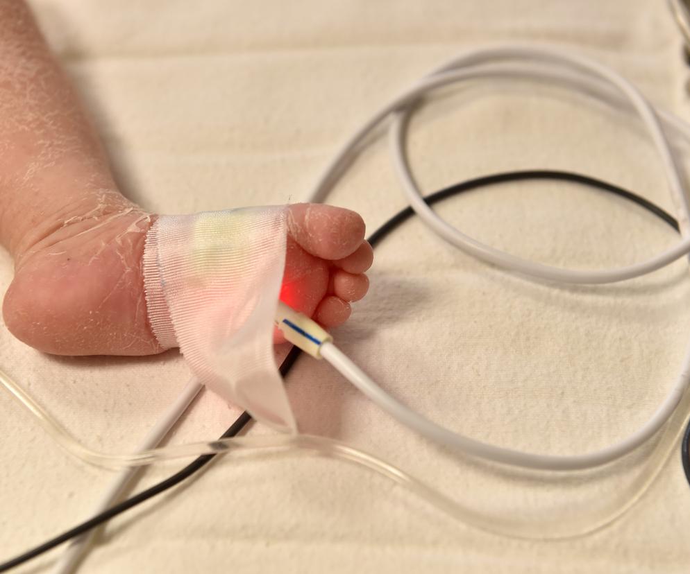 Niemowlę w szpitalu 