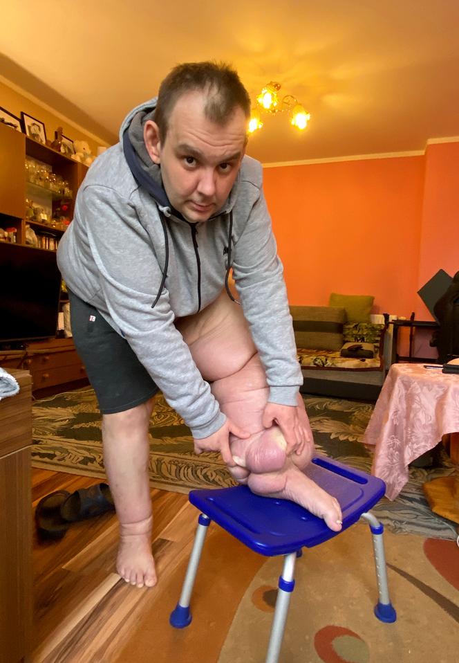 Paweł Kitlas (39 l.) z Białegostoku cierpi na tajemniczą chorobę. Lekarze w Polsce nie potrafią mu pomóc