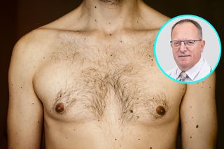 Onkolog: Panowie, badajcie się! Rak piersi atakuje też mężczyzn