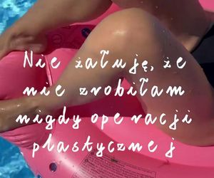 Dorota Szelągowska nie wstydzi się rozstępów