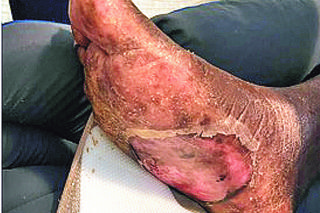 Zgotowali seniorom piekło by się wzbogacić