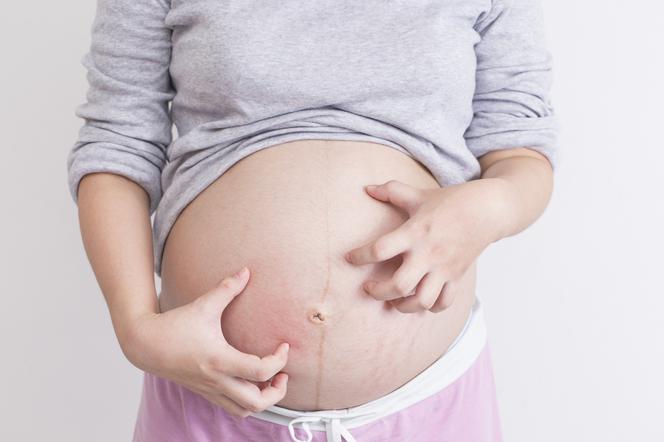Cholestaza w ciąży: jak nie przegapić tej groźnej choroby