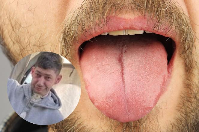 Przez raka stracił język. Ma nieuleczalny nowotwór i nie może pożegnać się z rodziną