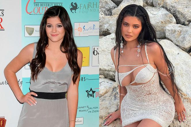 Żałuje że powiekszyła piersi! Szokujące wyznanie Kylie Jenner