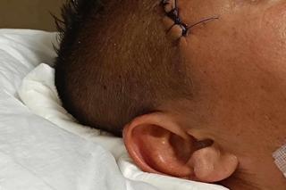 Tata czwórki dzieci uległ strasznemu wypadkowi. Andrzej potrzebuje pomocy