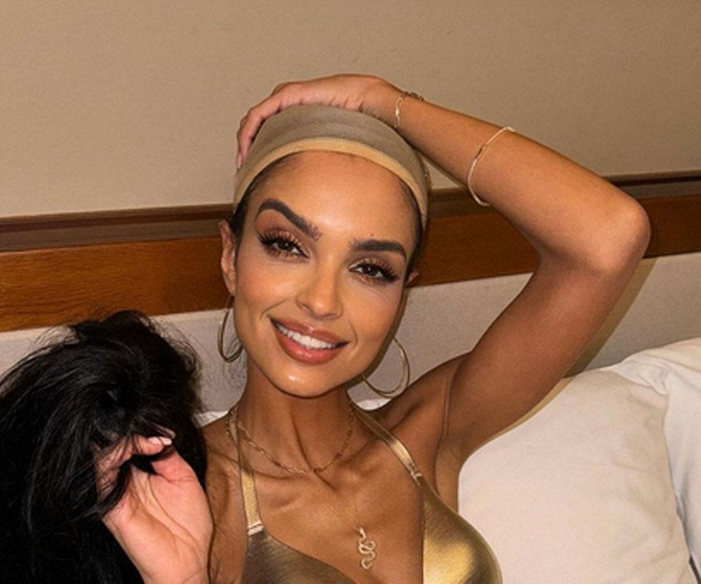 Klaudia El Dursi drastycznie schudła. Na co choruje gwiazda Top Model?