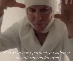 Krzysztof Gojdź zafundował sobie lifting twarzy. Zabieg jest bezbolesny