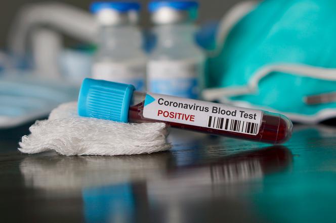 Koronawirus - test z krwi