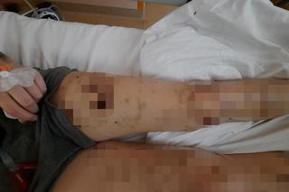 Sfora psów pogryzła 18-latkę pod Łaskiem. Ich właściciel nie przyznaje się do winy [ZDJĘCIA]. 