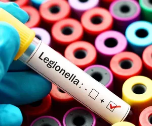 Legionella w Łódzkiem. Potwierdzono nowe zakażenia!