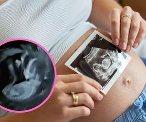 To robi dziecko w łonie matki, gdy ta wpada w złość. Staraj się być zawsze szczęśliwa