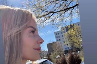 Dominika z Hotelu Paradise przeszła operację nosa. Pokazała efekty zabiegu