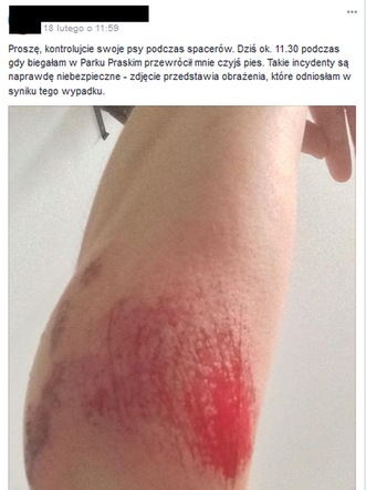 Pies rzucił się na biegającą w Parku Praskim