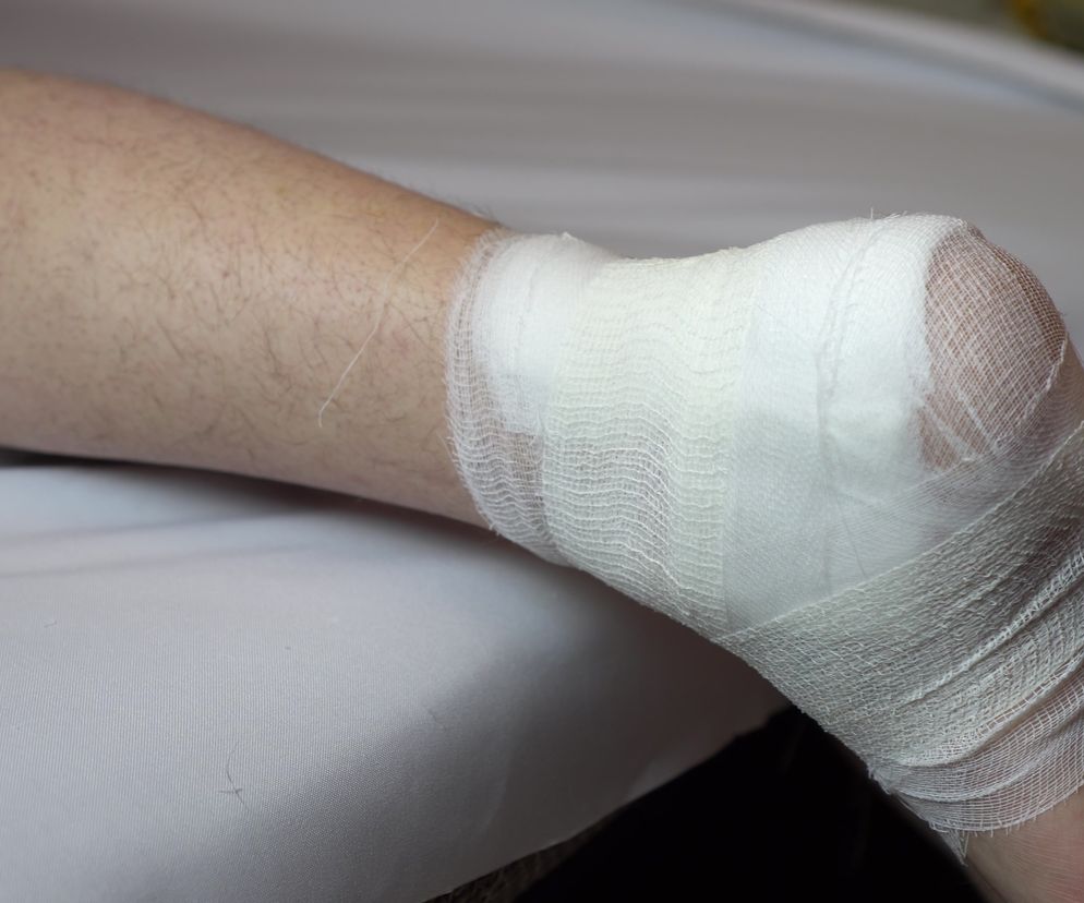 Polacy nie wiedzą, że są chorzy na cukrzycę. Z tego powodu liczba powikłań pocukrzycowych jest wysoka