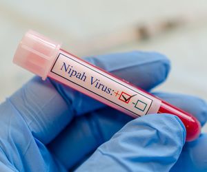 Wirus Nipah - objawy zakażenia, leczenie, zapobieganie 
