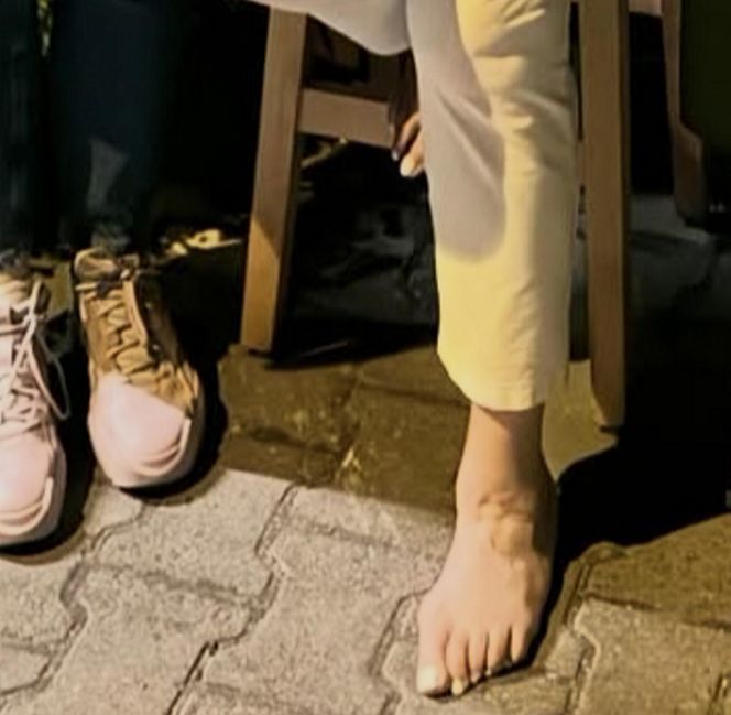 Magda Gessler w luksusowych sandałach ukrywa haluksy