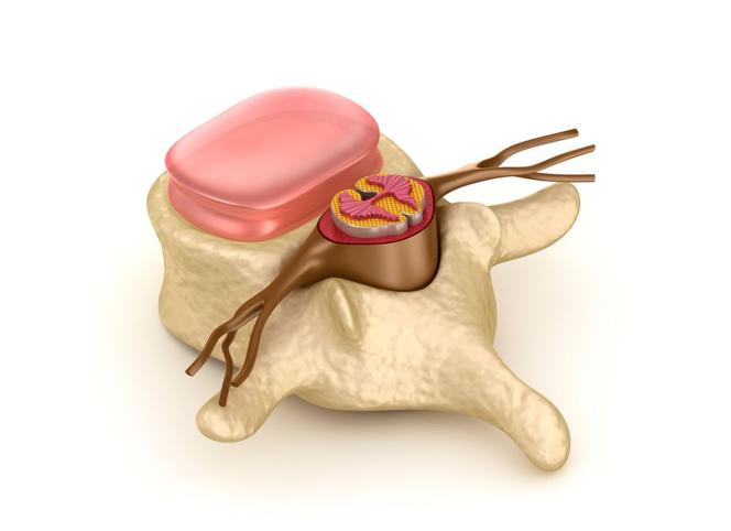 Regeneracja - nadzieja dla przerwanego rdzenia kręgowego