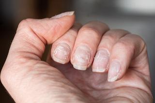 Manicure żelowy może mieć groźne konsekwencje. Naukowcy ostrzegają przed lampami UV